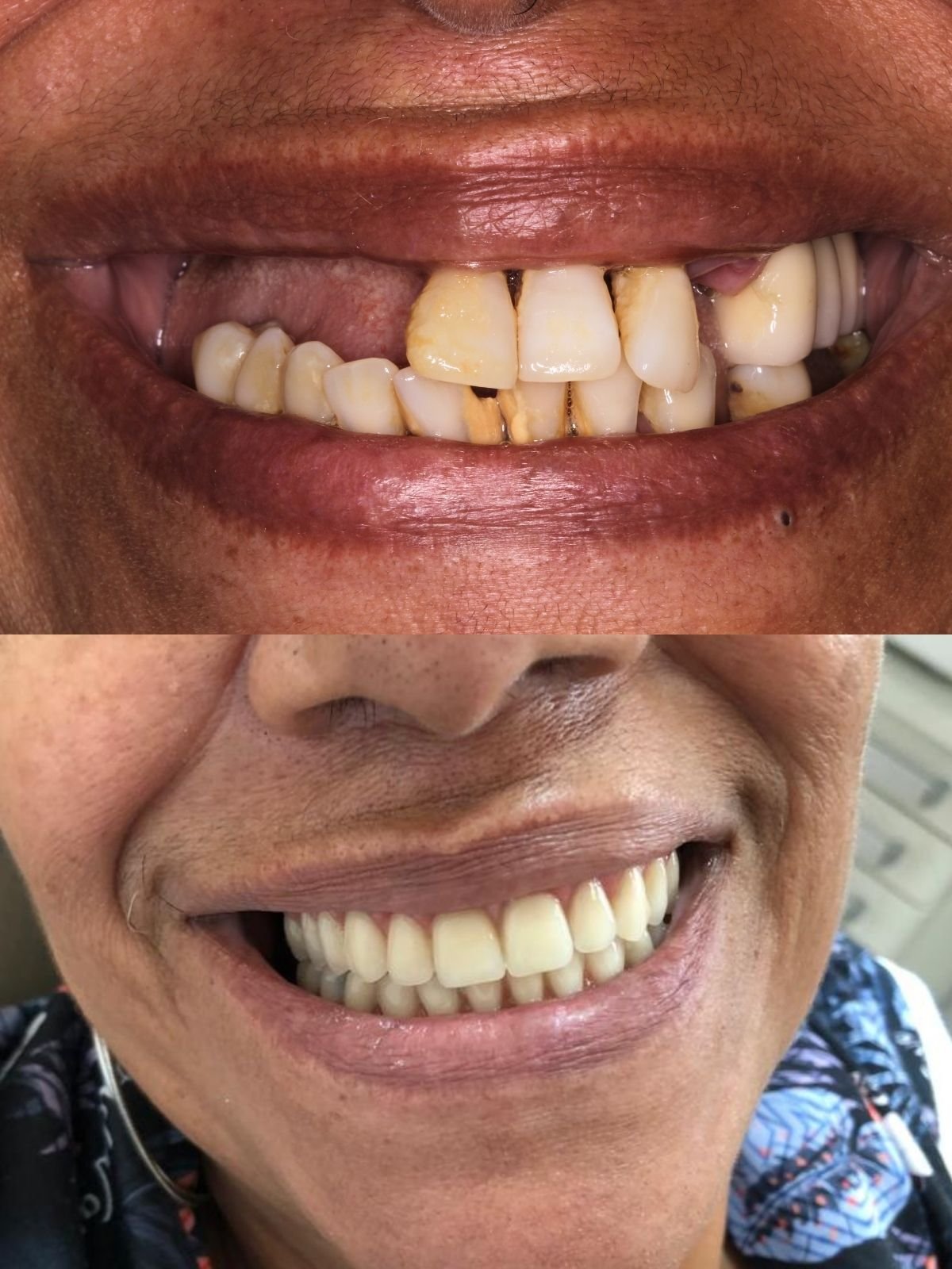 Especialista em implante dentário realizando atendimento em São Carlos.