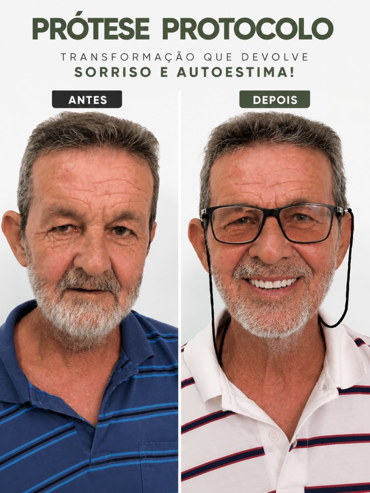 Prótese protocolo devolvendo conforto e qualidade de vida ao paciente